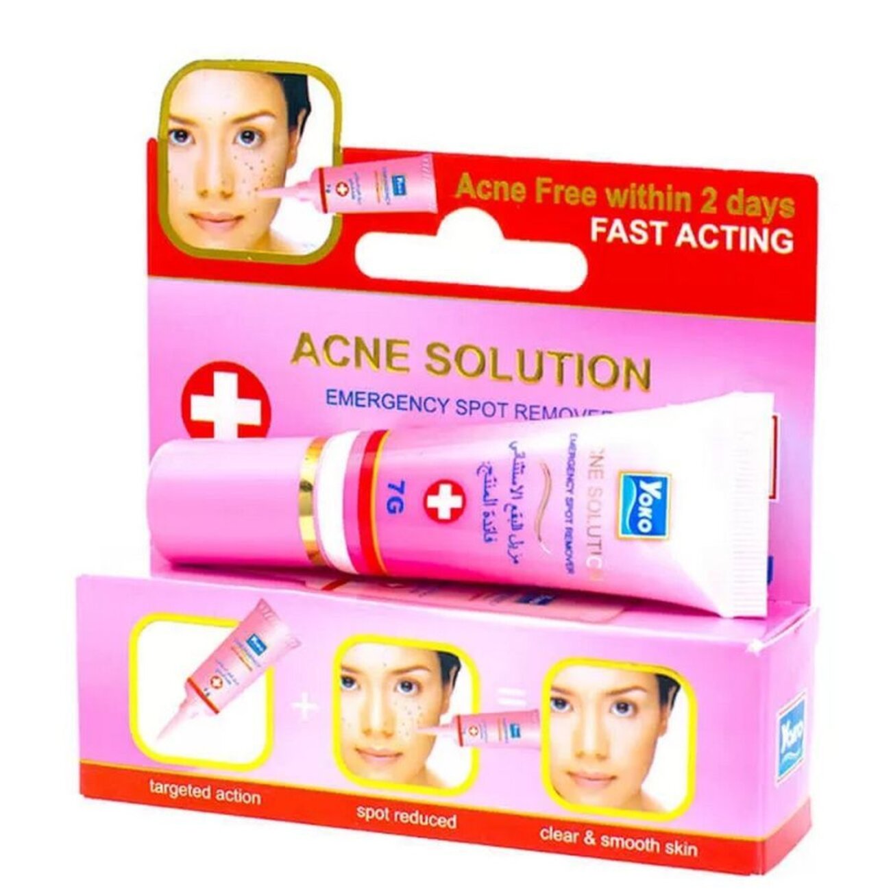 Siam Yoko Крем от угрей и прыщей быстрого действия / Acne Spots Cream, 7 г 548640 21507