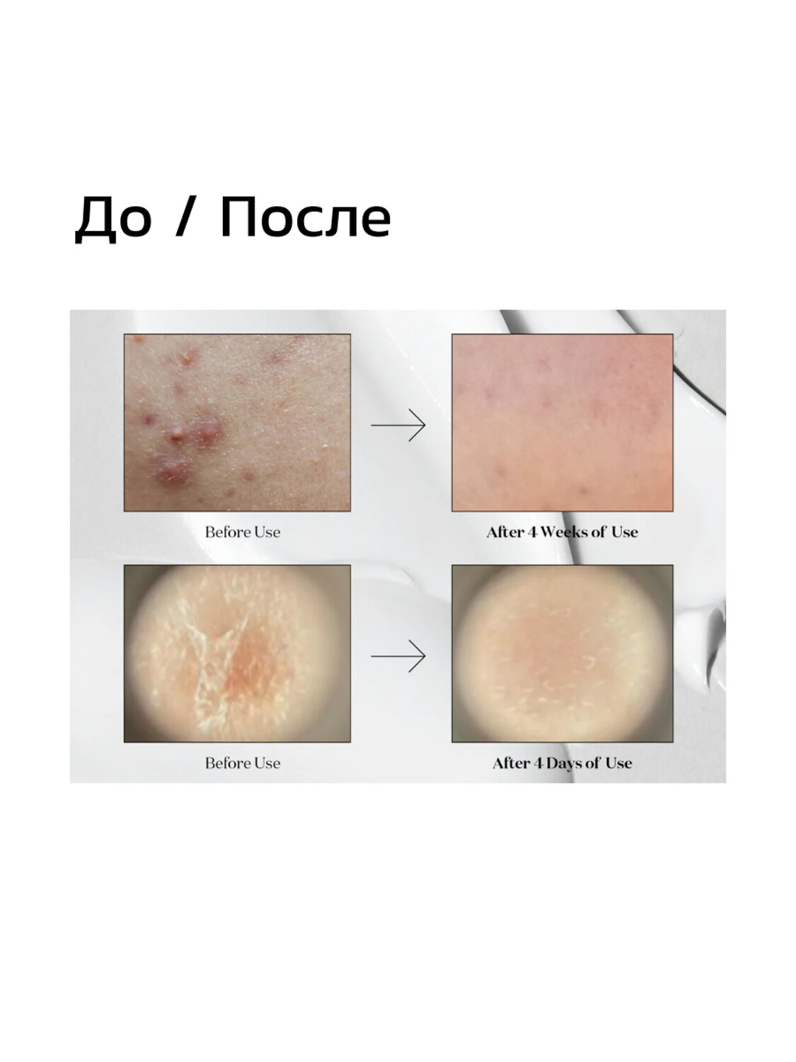 VT Cosmetics Мягкая бустер-сыворотка с микроиглами для гладкой и сияющей кожи / Midl Reedle Shot 50, 50 мл 548807 27947
