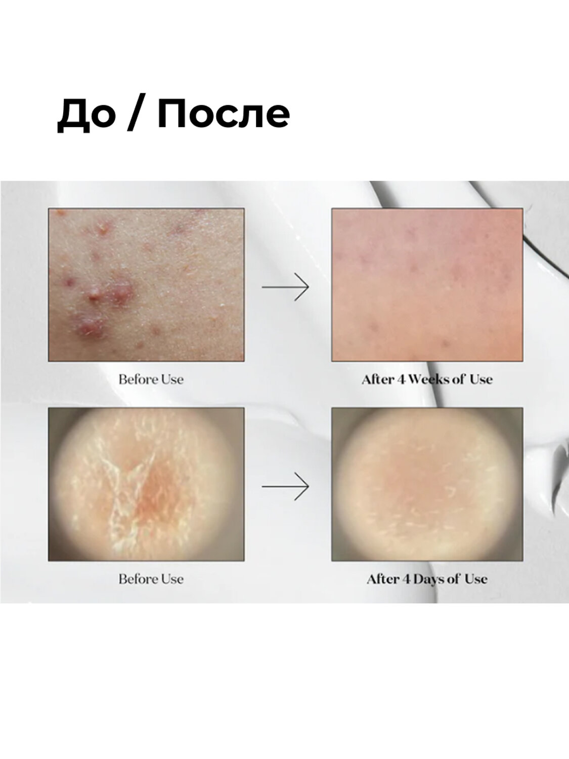 VT Cosmetics Бустер-сыворотка для лица с микроиглами и экстрактом центеллы азиатской / Reedle Shot 100, 50 мл 548842 27948