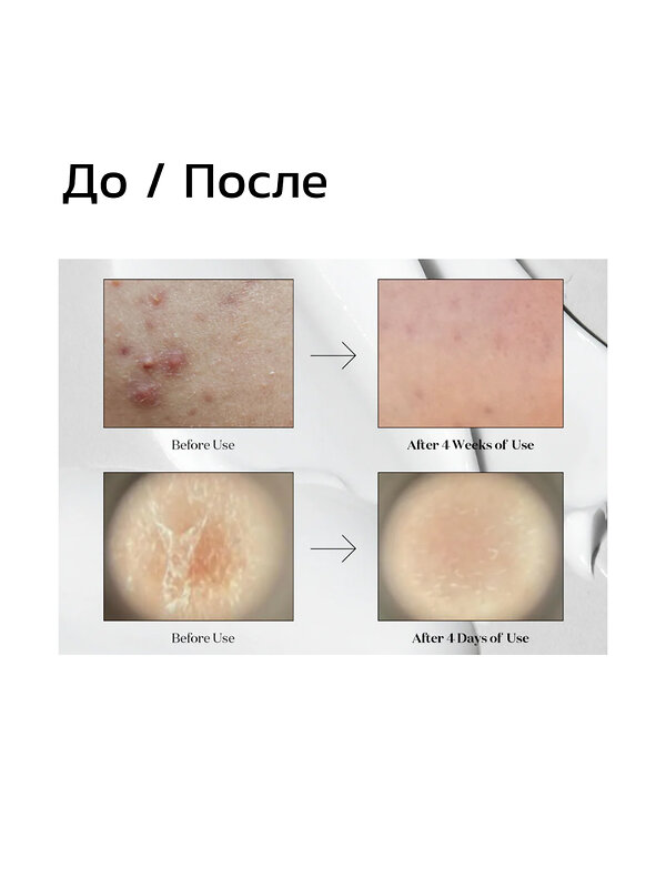 VT Cosmetics Мягкая бустер-сыворотка с микроиглами для гладкой и сияющей кожи / Midl Reedle Shot 50, 50 мл 548807 27947