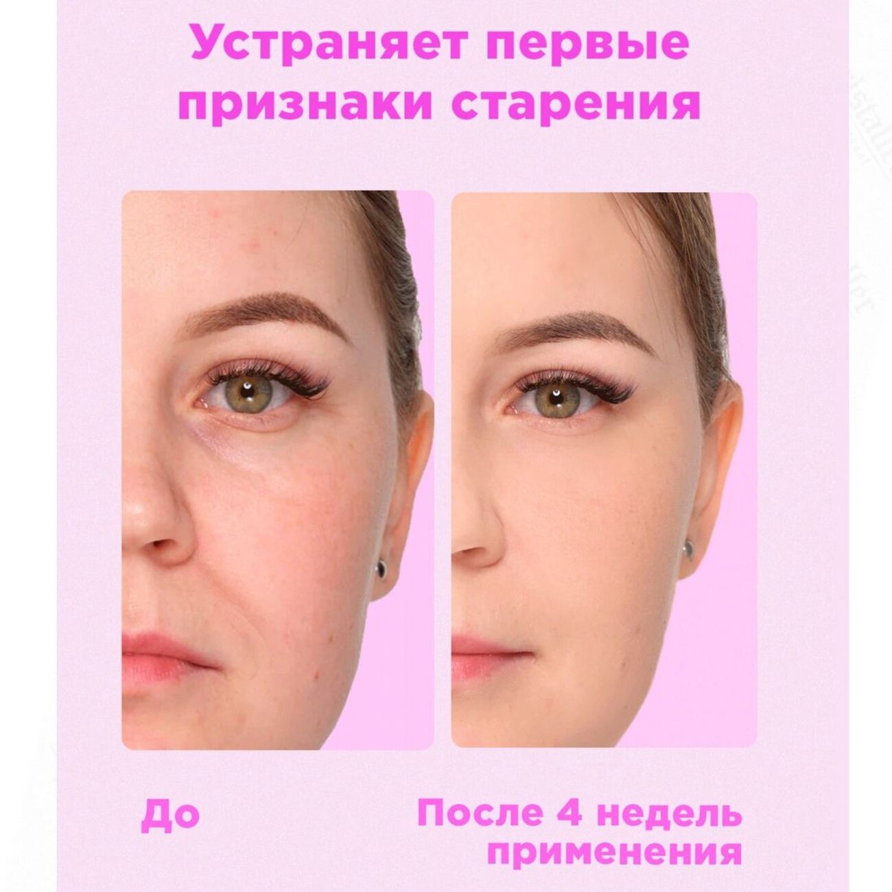 Likato Тоник с фруктовыми кислотами AHA 7%, 150 мл 589383 18010 