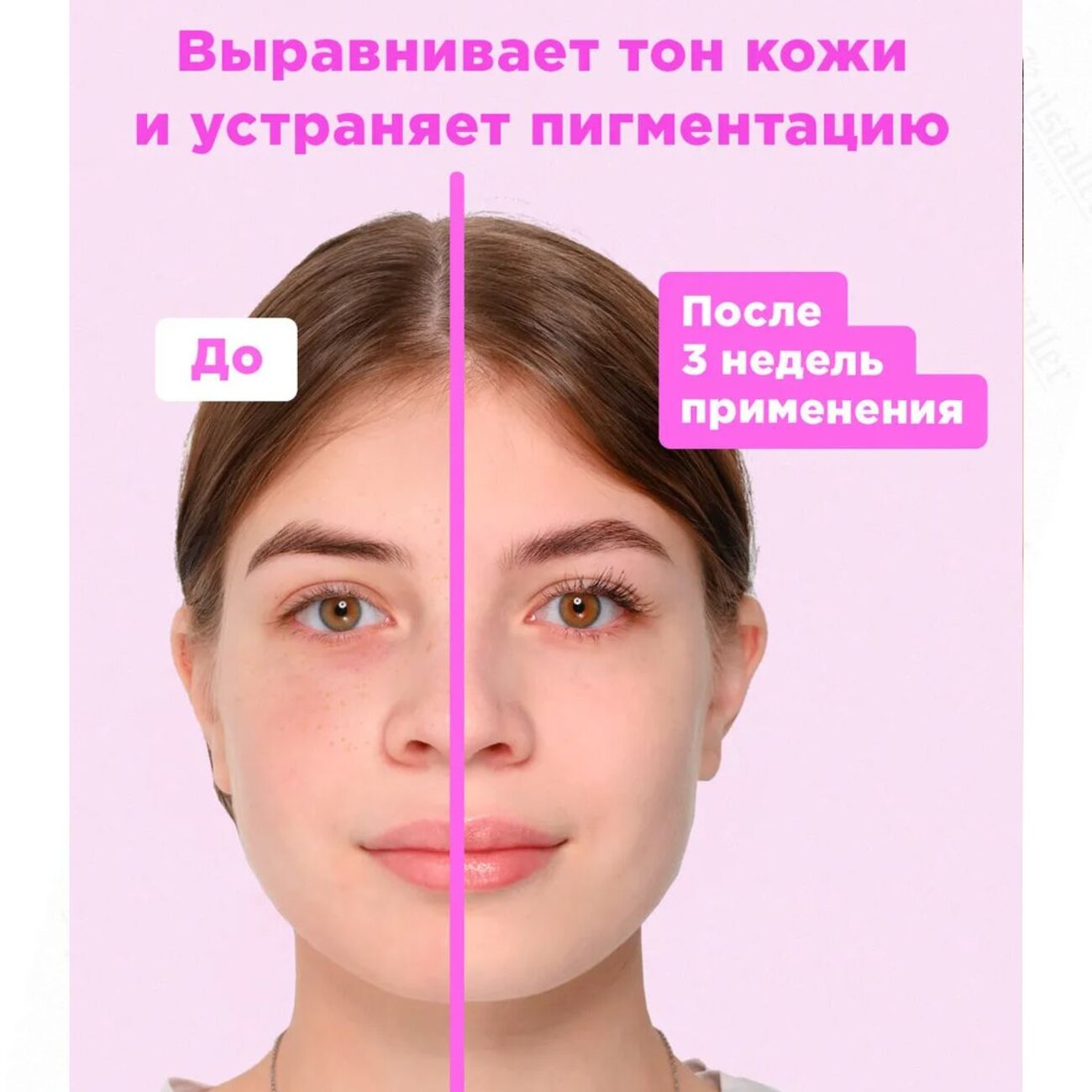 Likato Тоник с фруктовыми кислотами AHA 7%, 150 мл 589383 18010 