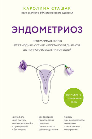 Эксмо Каролина Сташак "Эндометриоз. Программа лечения: от самодиагностики и постановки диагноза до полного избавления от болей" 352251 978-5-04-159432-9 