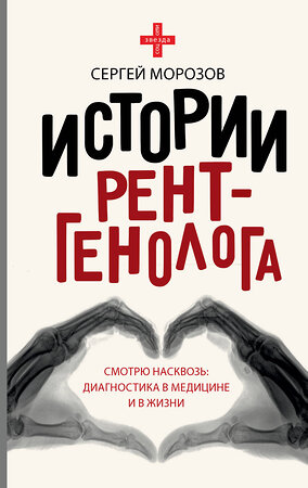 АСТ Сергей Морозов "Истории рентгенолога. Смотрю насквозь: диагностика в медицине и в жизни." 367245 978-5-17-109892-6 