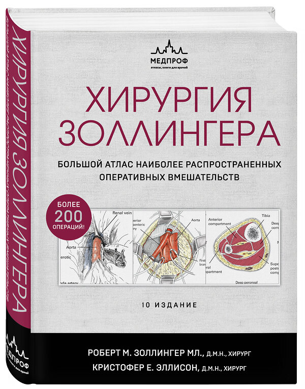 Эксмо Роберт Золлингер, Кристофер Эллисон "Хирургия Золлингера. Большой атлас наиболее распространенных оперативных вмешательств" 348481 978-5-04-117770-6 