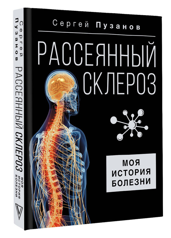 АСТ Сергей Пузанов "Рассеянный склероз. Моя история болезни" 428527 978-5-17-160915-3 