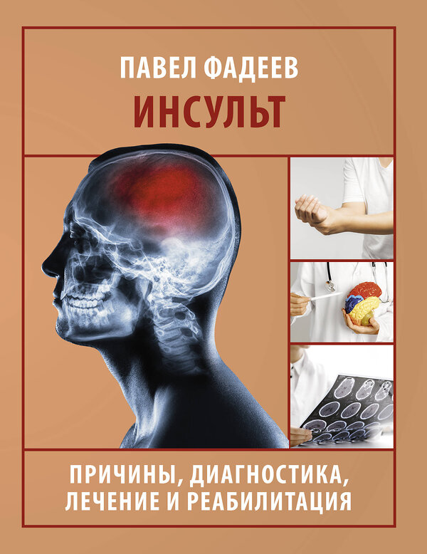 АСТ Павел Фадеев "Инсульт. Причины, диагностика, лечение и реабилитация" 469558 978-5-17-166122-9 