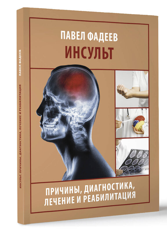 АСТ Павел Фадеев "Инсульт. Причины, диагностика, лечение и реабилитация" 469558 978-5-17-166122-9 