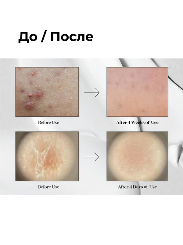VT Cosmetics Бустер-сыворотка для лица с микроиглами и экстрактом центеллы азиатской / Reedle Shot 100, 50 мл 548842 27948 