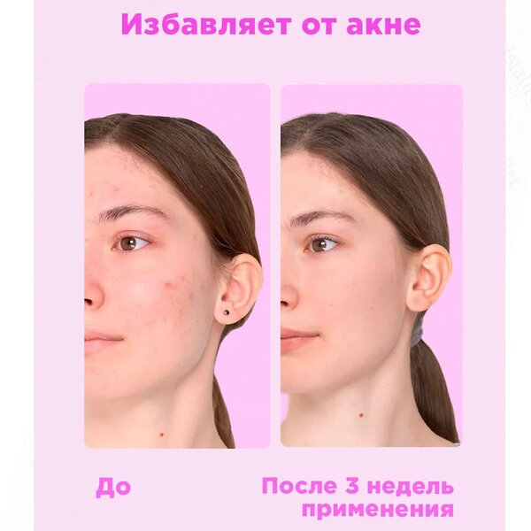 Likato Тоник с фруктовыми кислотами AHA 7%, 150 мл 589383 18010 